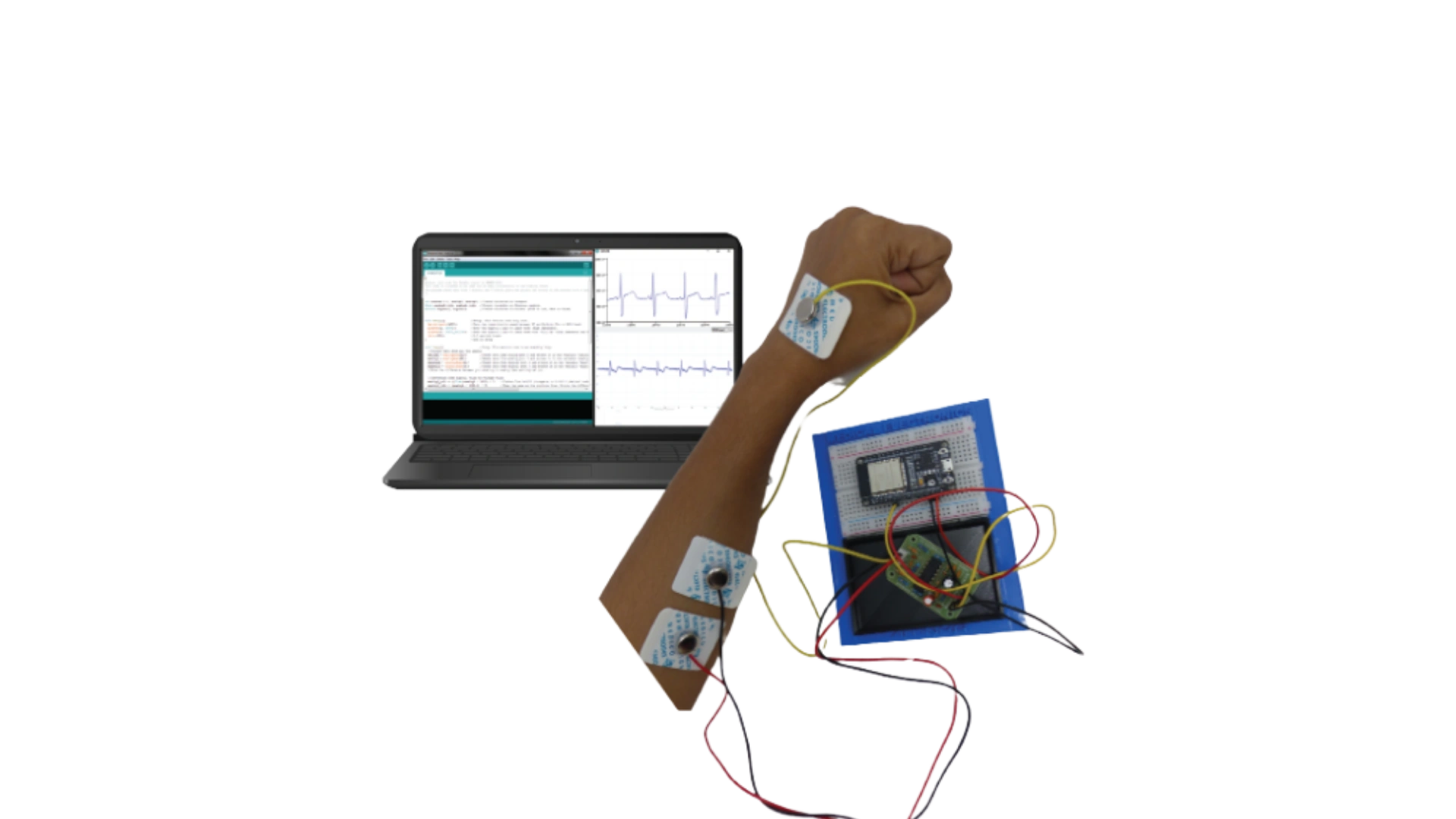 AI in HealthCare